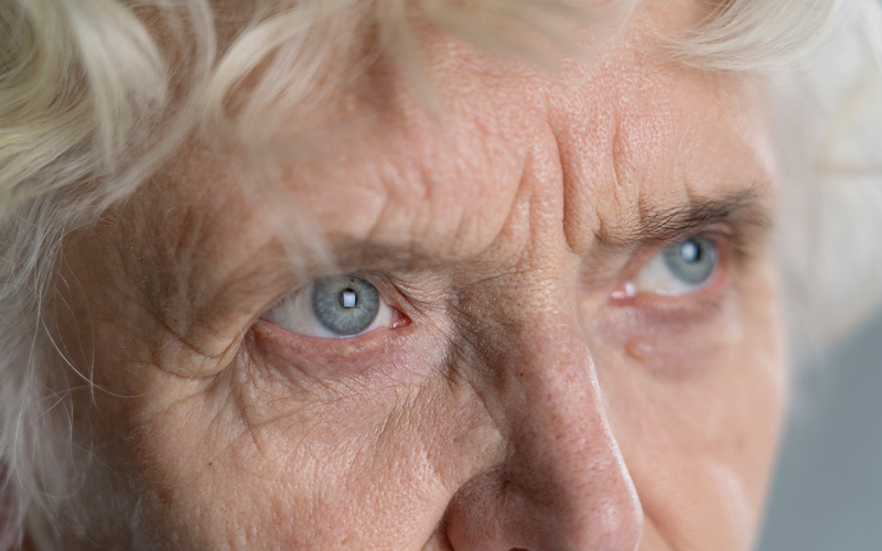 Tratamento Cirúrgico do Glaucoma